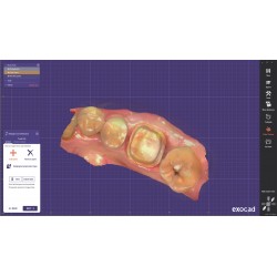 Scanner 3D AoralScan 3 offre une qualité exemplaire de numérisation