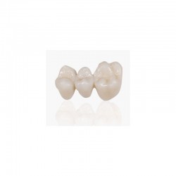 DWS LFAB, Restauration dentaire provisoire avec résine bio-compatible classe IIa