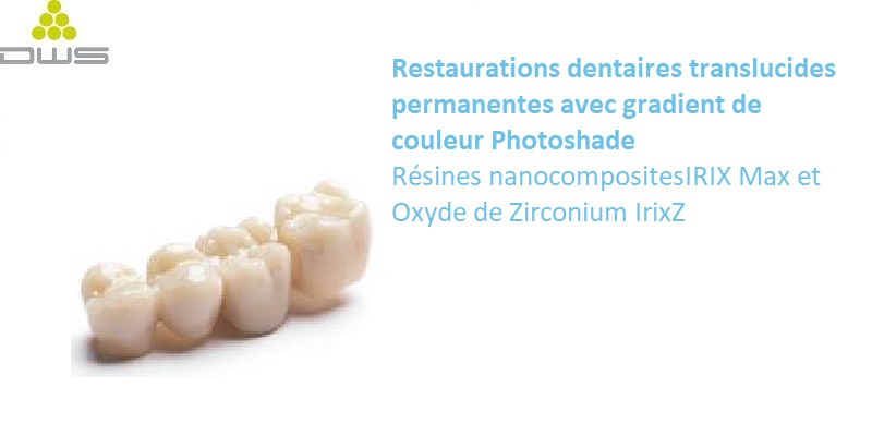 DWS DFAB impression restauration translucide gradient de couleur