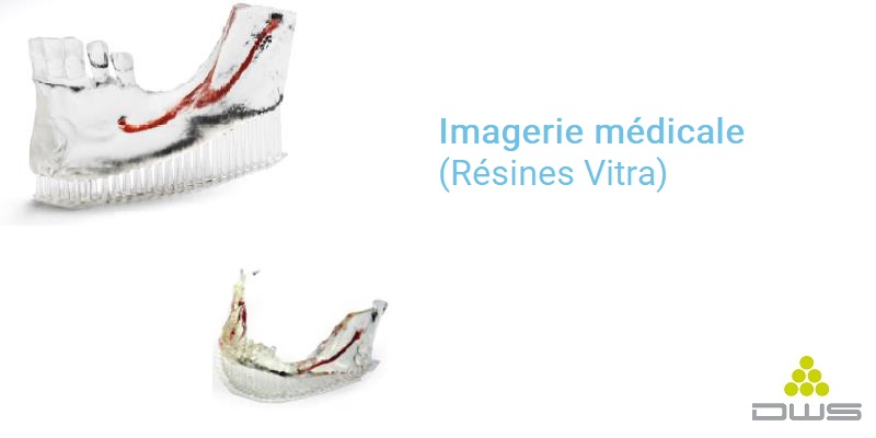 DWS XFAB 2500PD impression pour imagerie médicale