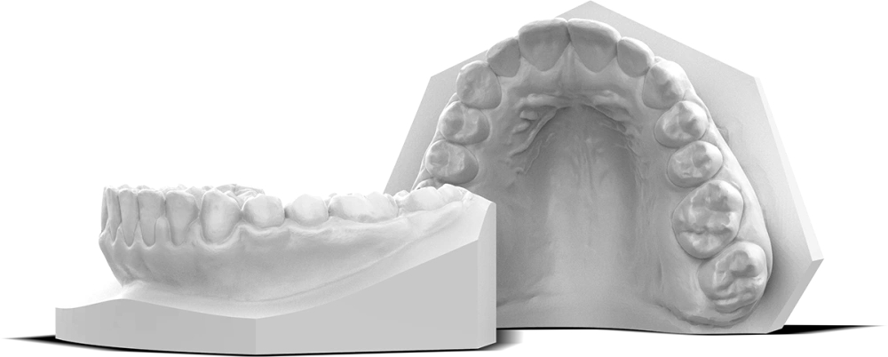 Modèle dentaire imprimé avec Study Model white