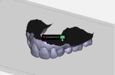 Réparation de fichier de scan intra-oral avec Rayware