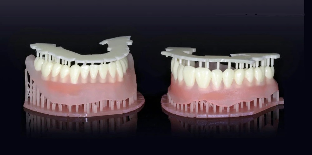 Sprintray Pro: Modèles dentaires multi-matériaux