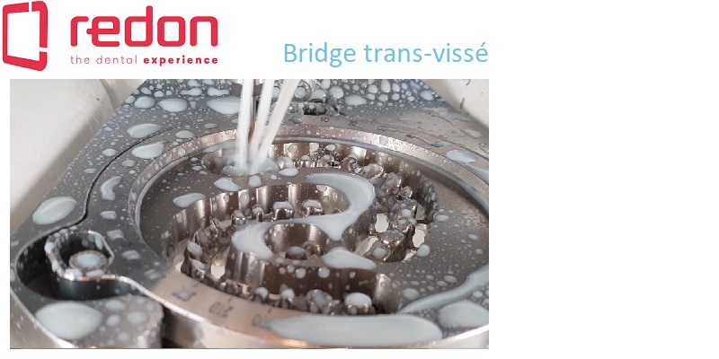 Redon hybrid bridge trans-vissé