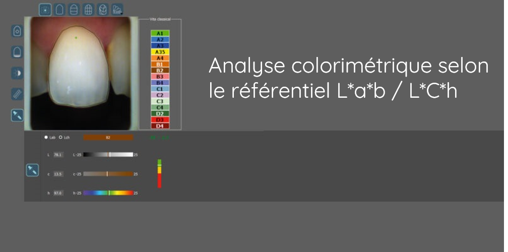 Vue de l'outil d'analyse colorimétrique