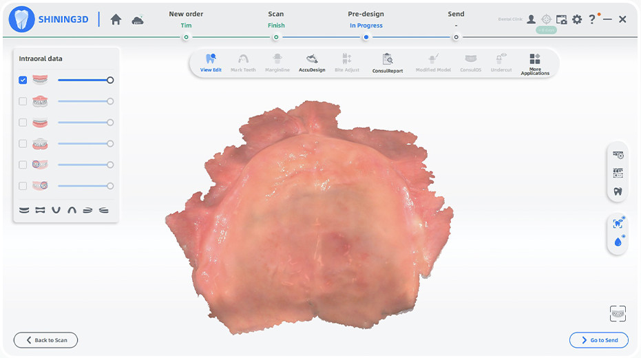 imagerie d'un palai avec photogrammétrie intra-orale de l'Aoralscan Elite