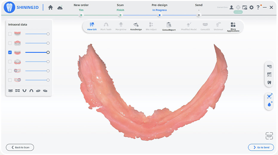 imagerie d'un palai avec photogrammétrie intra-orale de l'Aoralscan Elite