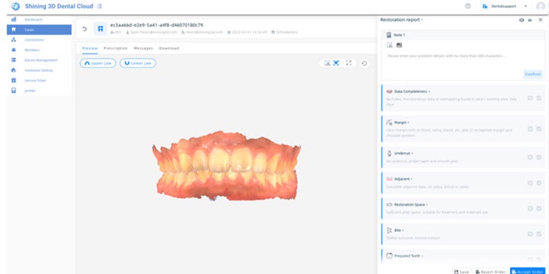 Shining 3D Aoralscan 3 sans fil permet aussi une évaluation des données précise