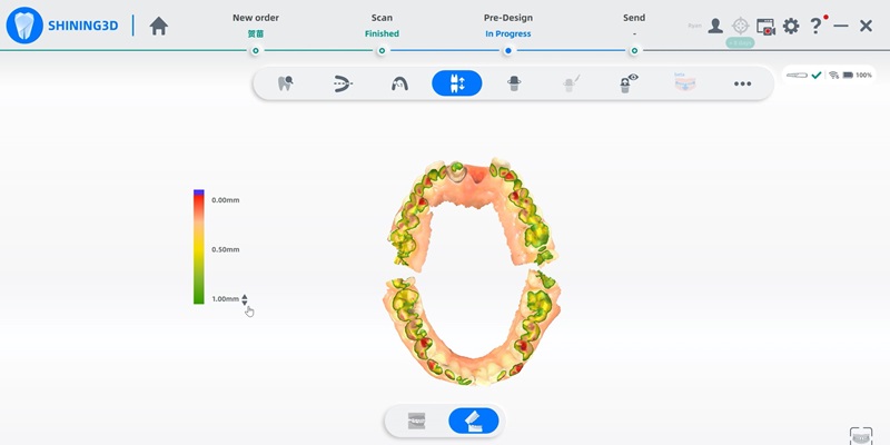 Shining 3D Aoralscan 3 sans fil vérification de l'alignement occlusal