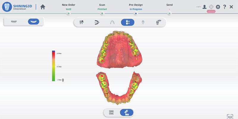 Vérification de l'occlusion avec AoralScan 3