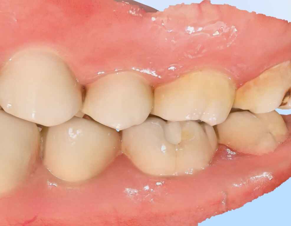 Gravure ultra précise en 16K avec Omni X