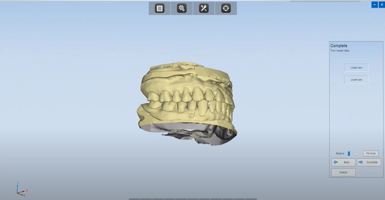 AutoScan DS-EX Pro: Intégration avec les logiciels de CAO dentaire (Dental Wings, 3Shape, Exocad...)