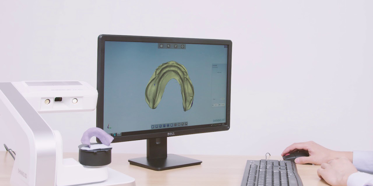 Logiciel Dentalscan des scanners dentaires Autoscan DS-EX