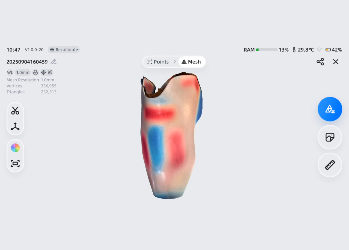 image d'une porthèse réalisé à l'aide du scanner 3D EinScan Medixa de Shining 3d