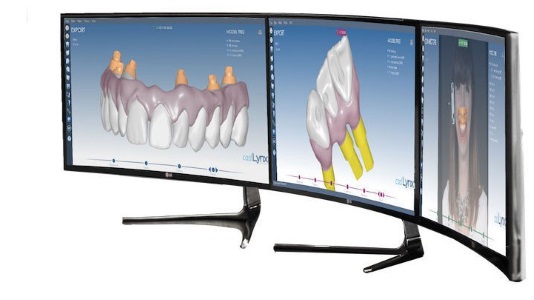 Vue d'écrans CAD Lynx
