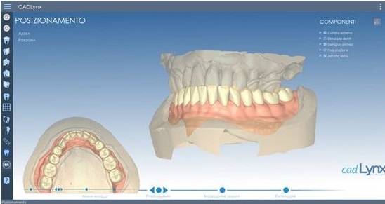 Vue d'écrans CAD Lynx, Modèle dentaire