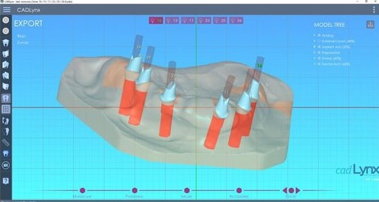 Vue d'écran CAD Lynx, Implants