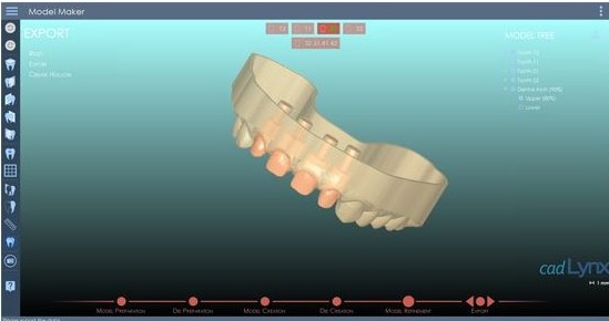Vue d'écrans CAD Lynx, Implants