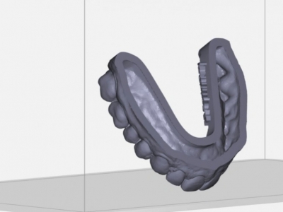 Modèles d’impression 3D : creux vs solide par SprintRay